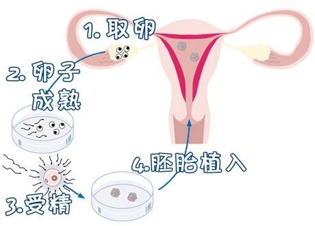 生殖医学中心